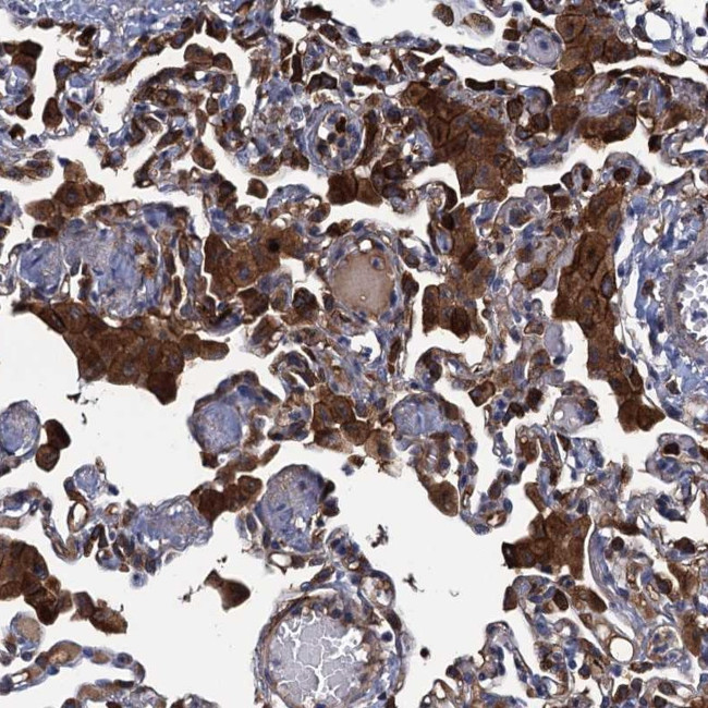 DNHD1 Antibody in Immunohistochemistry (Paraffin) (IHC (P))