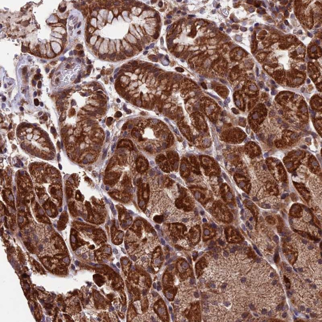 RNF17 Antibody in Immunohistochemistry (Paraffin) (IHC (P))