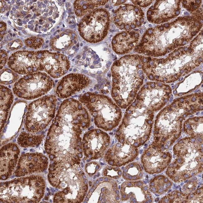 KIAA1468 Antibody in Immunohistochemistry (Paraffin) (IHC (P))