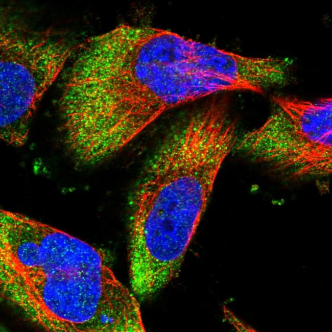 DCP1B Antibody in Immunocytochemistry (ICC/IF)