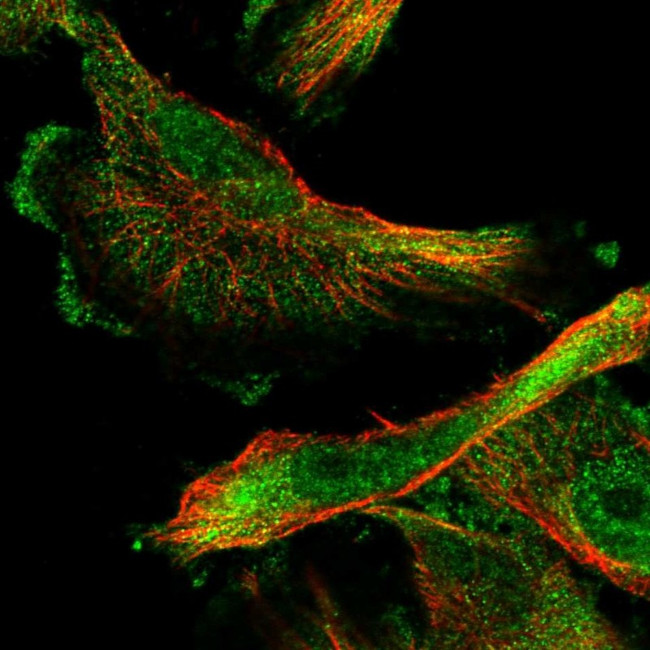 SMAGP Antibody in Immunocytochemistry (ICC/IF)