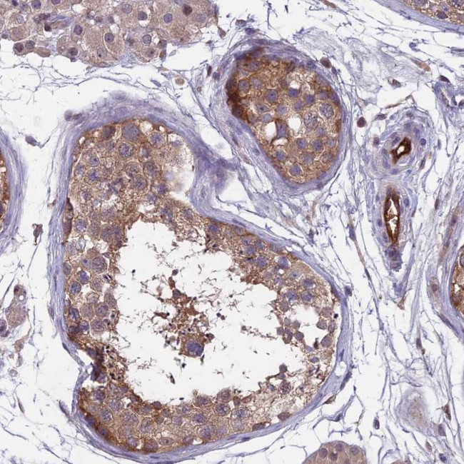 MAST2 Antibody in Immunohistochemistry (Paraffin) (IHC (P))