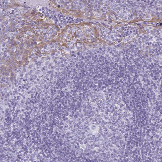 KRT78 Antibody in Immunohistochemistry (Paraffin) (IHC (P))