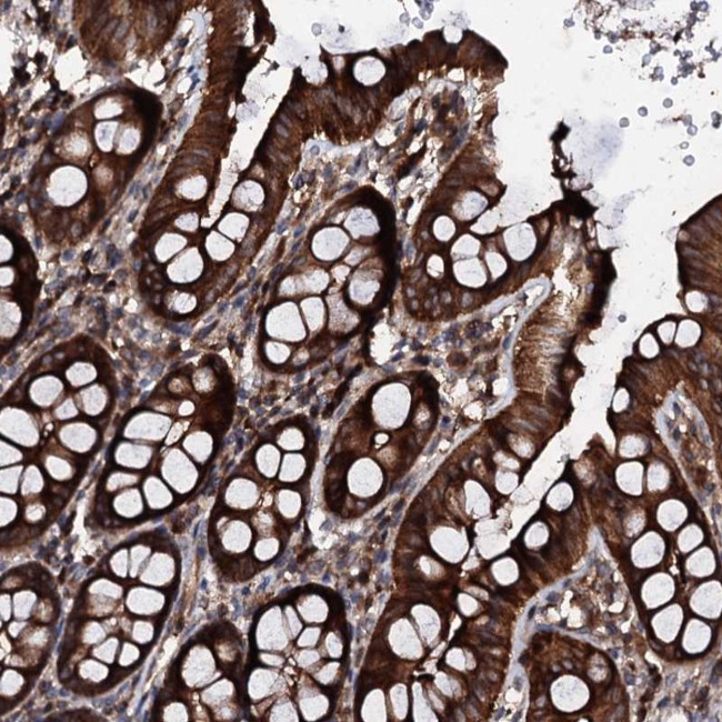 C11orf79 Antibody in Immunohistochemistry (Paraffin) (IHC (P))