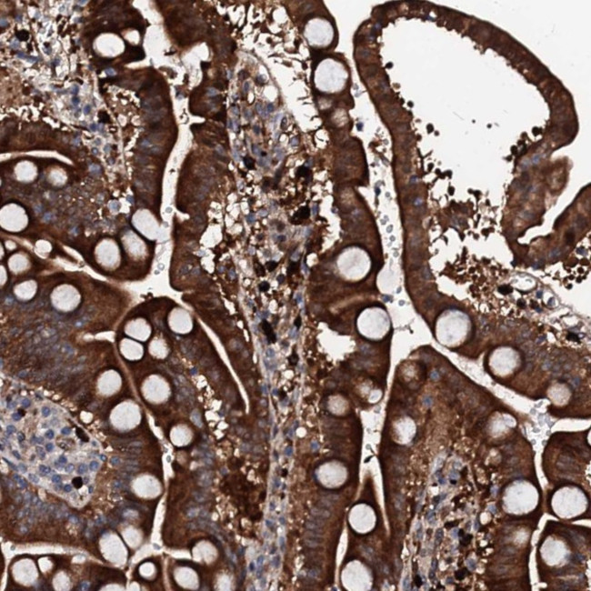 BTNL8 Antibody in Immunohistochemistry (Paraffin) (IHC (P))