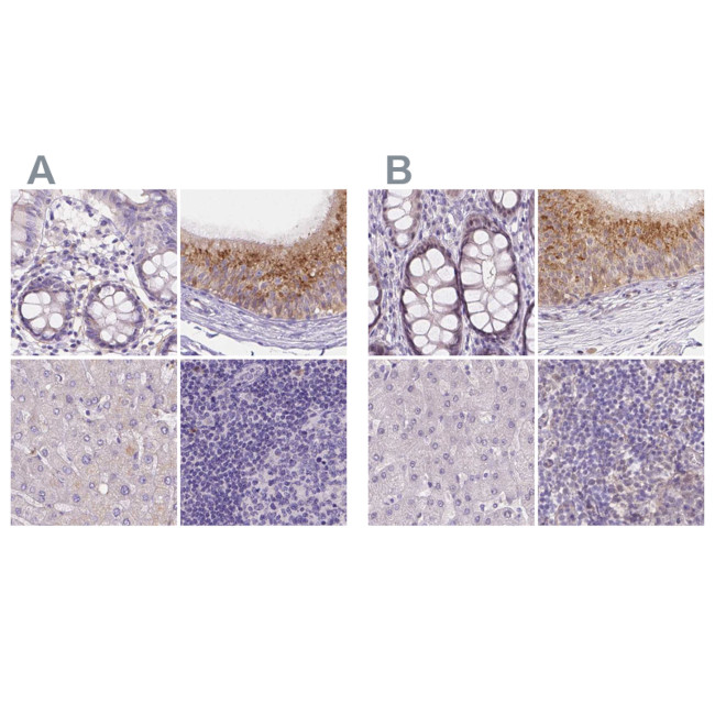 NXPE2 Antibody in Immunohistochemistry (IHC)