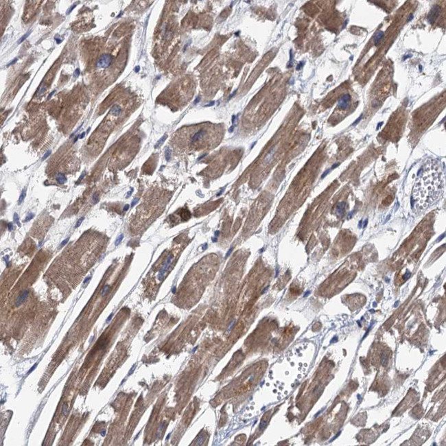 TPCN1 Antibody in Immunohistochemistry (Paraffin) (IHC (P))