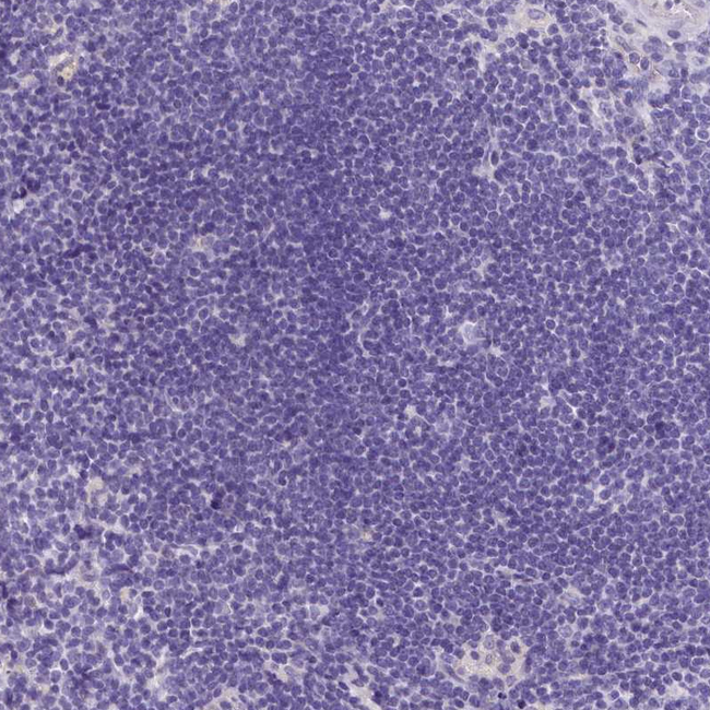 INSC Antibody in Immunohistochemistry (Paraffin) (IHC (P))