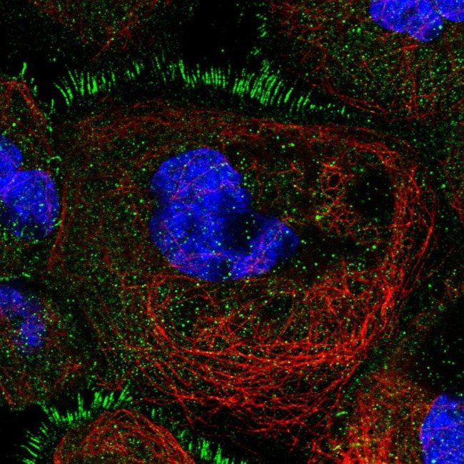 TBC1D30 Antibody in Immunocytochemistry (ICC/IF)