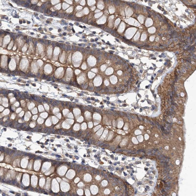 ZNF324 Antibody in Immunohistochemistry (Paraffin) (IHC (P))