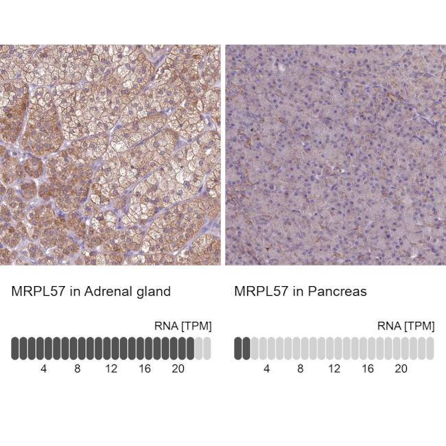 MRPL57 Antibody in Immunohistochemistry (IHC)