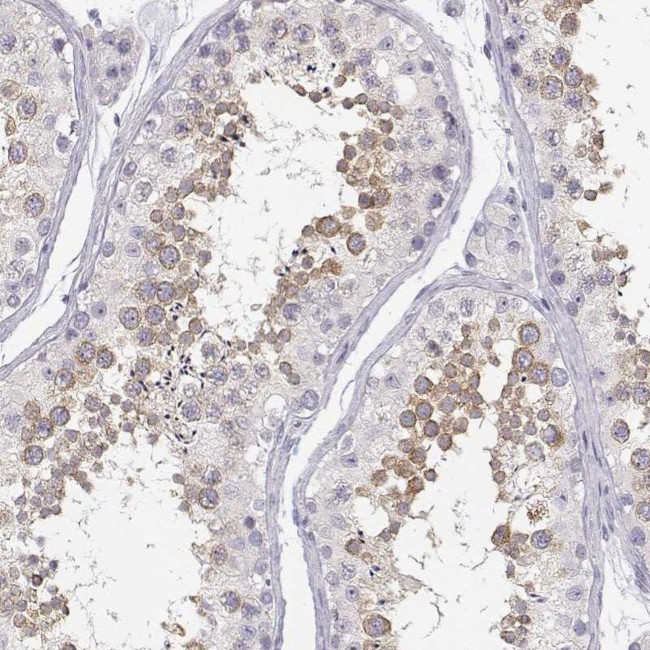 GLIPR1L2 Antibody in Immunohistochemistry (IHC)