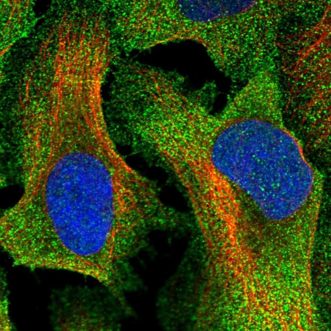 TTC23 Antibody in Immunocytochemistry (ICC/IF)