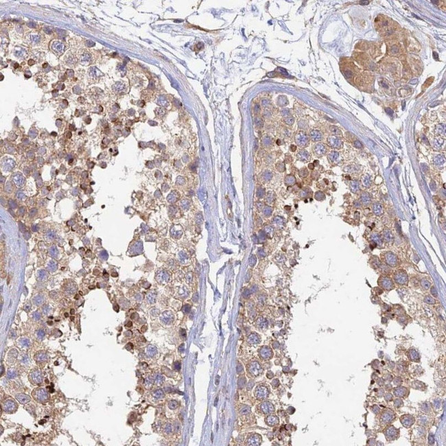 MYO9A Antibody in Immunohistochemistry (IHC)