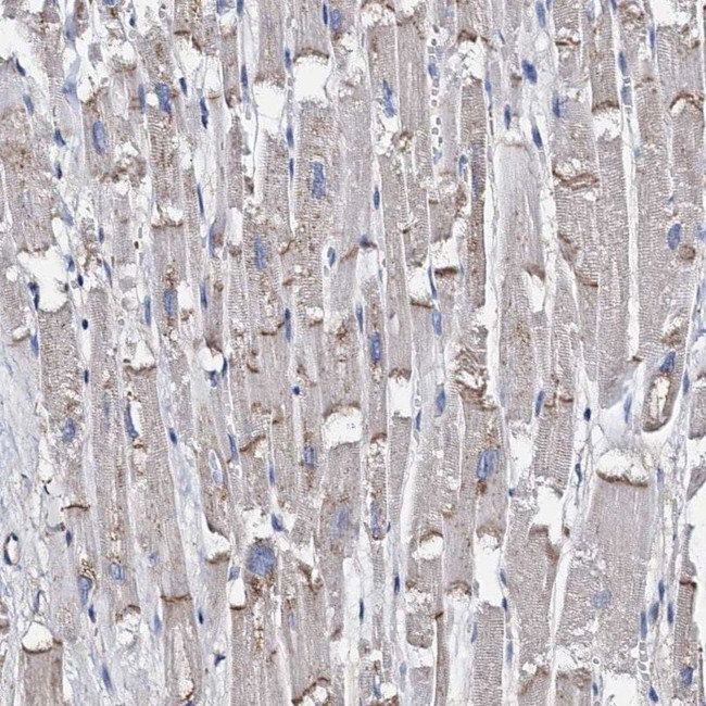 MYZAP Antibody in Immunohistochemistry (IHC)