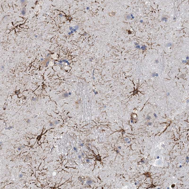 RIN3 Antibody in Immunohistochemistry (Paraffin) (IHC (P))