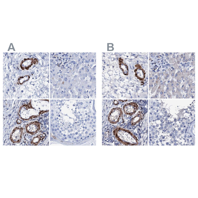 NRIP2 Antibody in Immunohistochemistry (IHC)
