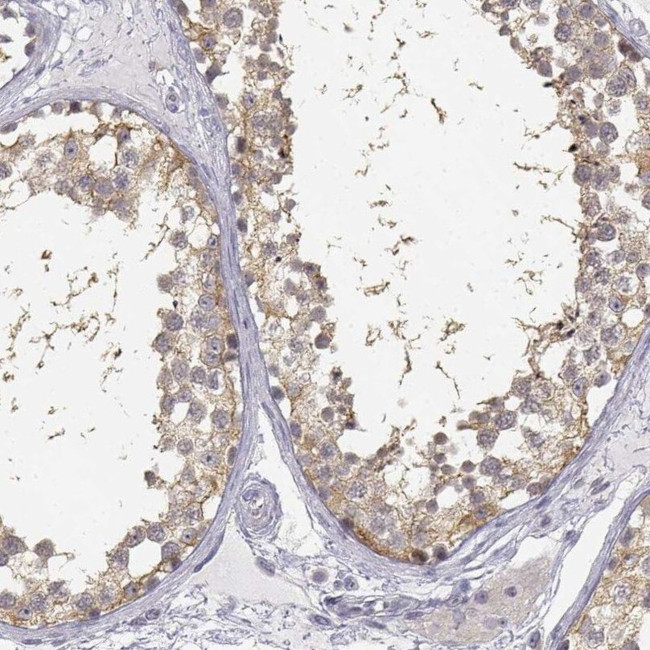 GLIPR1L2 Antibody in Immunohistochemistry (IHC)