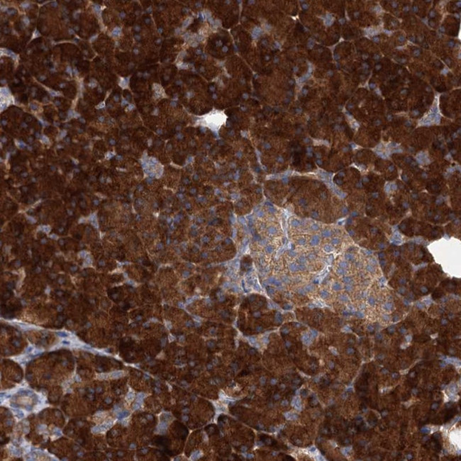 ALKBH7 Antibody in Immunohistochemistry (Paraffin) (IHC (P))