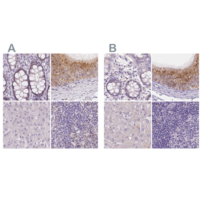 NXPE2 Antibody in Immunohistochemistry (IHC)