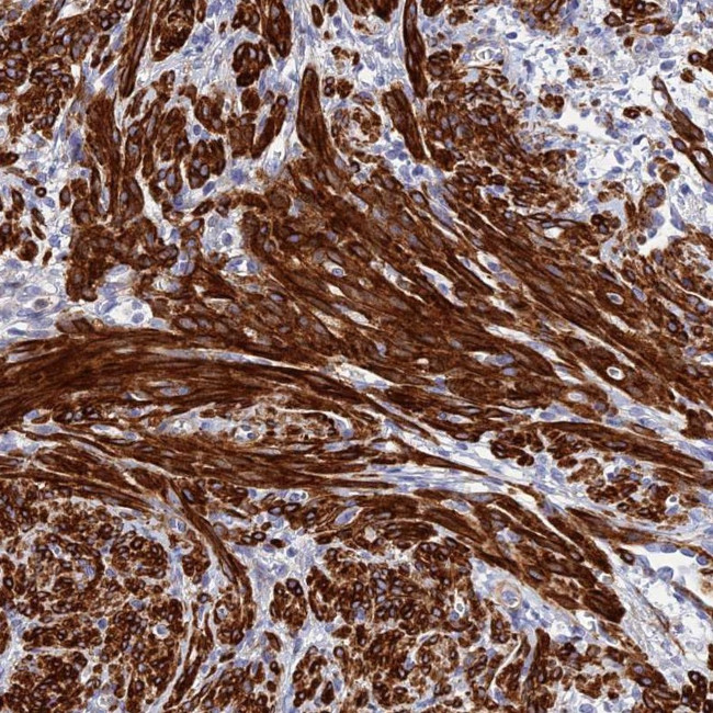 ZDHHC16 Antibody in Immunohistochemistry (Paraffin) (IHC (P))