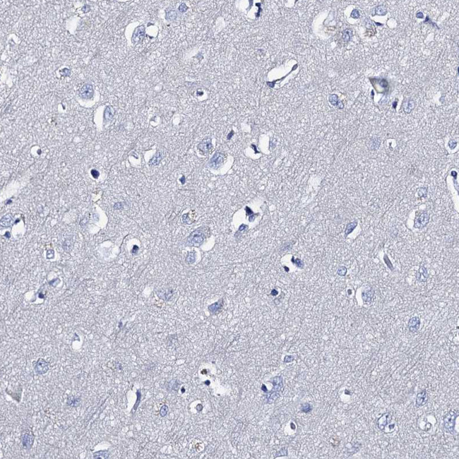 TMEM72 Antibody in Immunohistochemistry (Paraffin) (IHC (P))