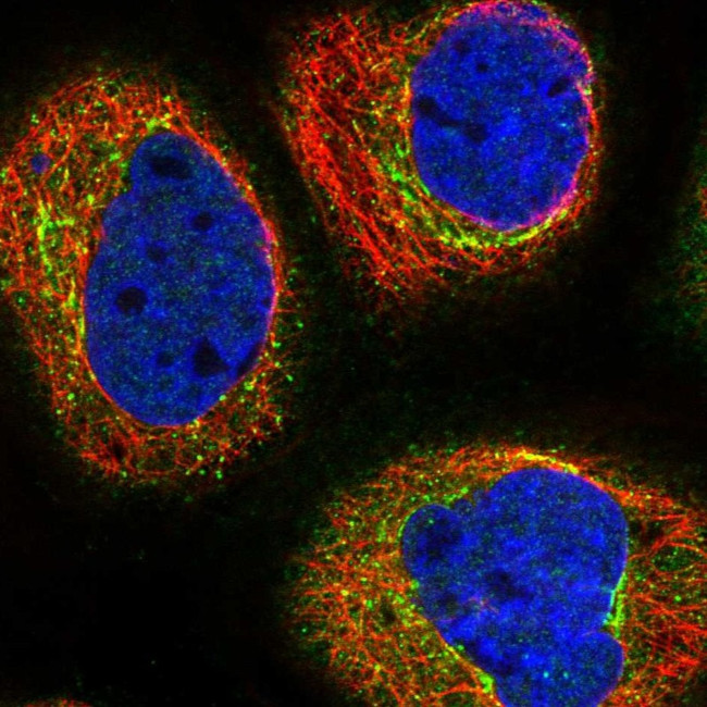 TCTN2 Antibody in Immunocytochemistry (ICC/IF)