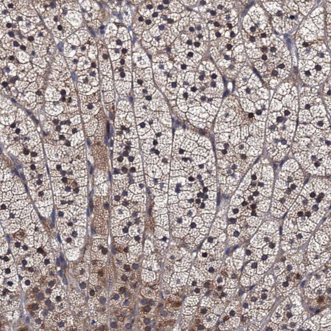 TRMT112 Antibody in Immunohistochemistry (IHC)