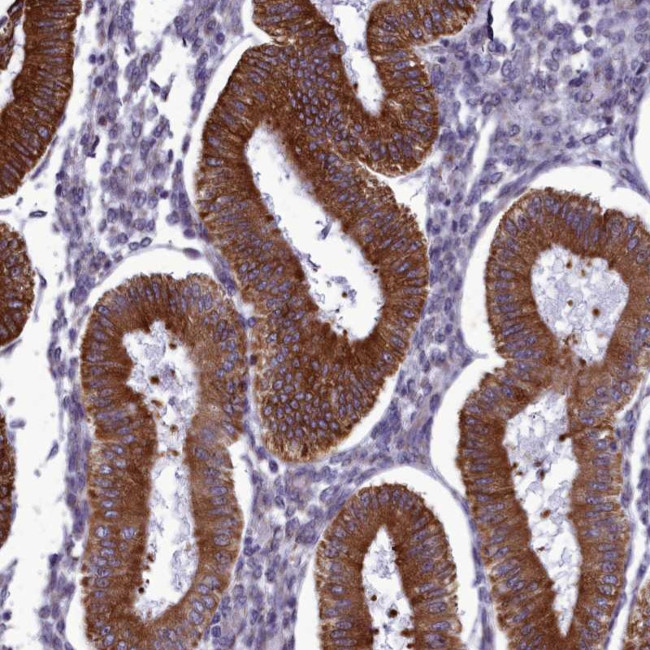 CCDC84 Antibody in Immunohistochemistry (Paraffin) (IHC (P))