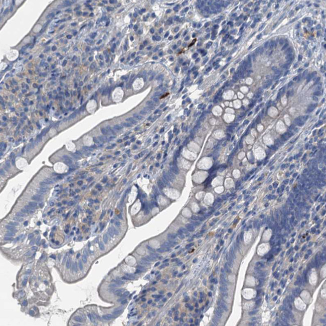 GIF Antibody in Immunohistochemistry (Paraffin) (IHC (P))