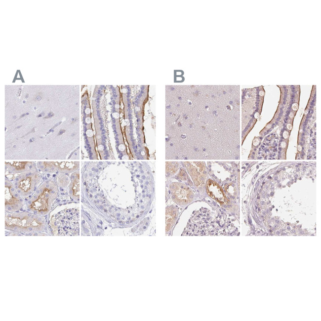 TREH Antibody in Immunohistochemistry (IHC)