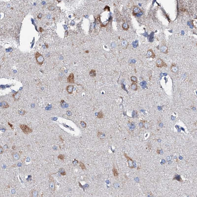 GLB1L3 Antibody in Immunohistochemistry (Paraffin) (IHC (P))