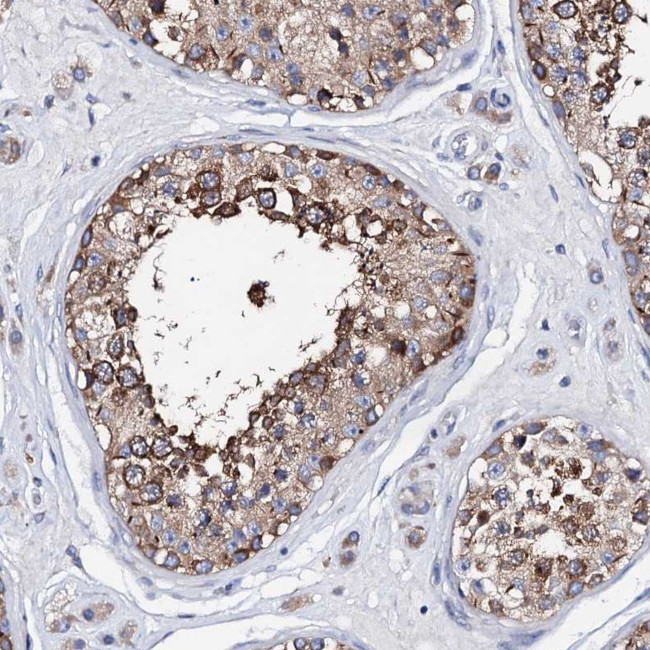 ATP8A2 Antibody in Immunohistochemistry (Paraffin) (IHC (P))