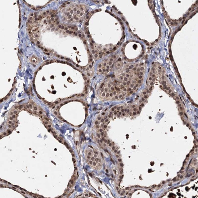 PIGB Antibody in Immunohistochemistry (Paraffin) (IHC (P))