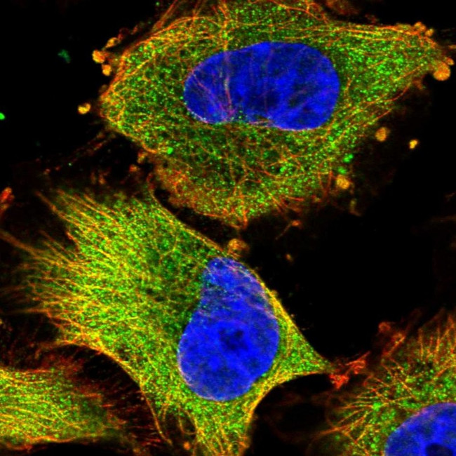 NDUFAF1 Antibody in Immunocytochemistry (ICC/IF)