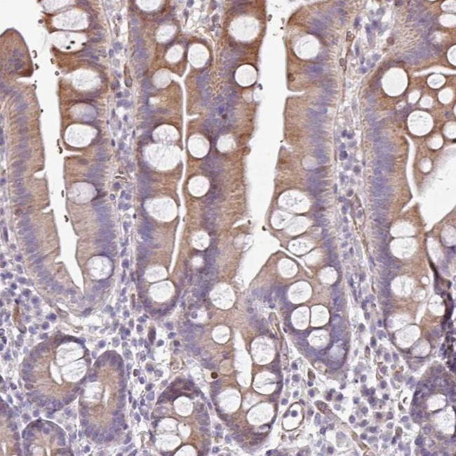 ANO9 Antibody in Immunohistochemistry (IHC)
