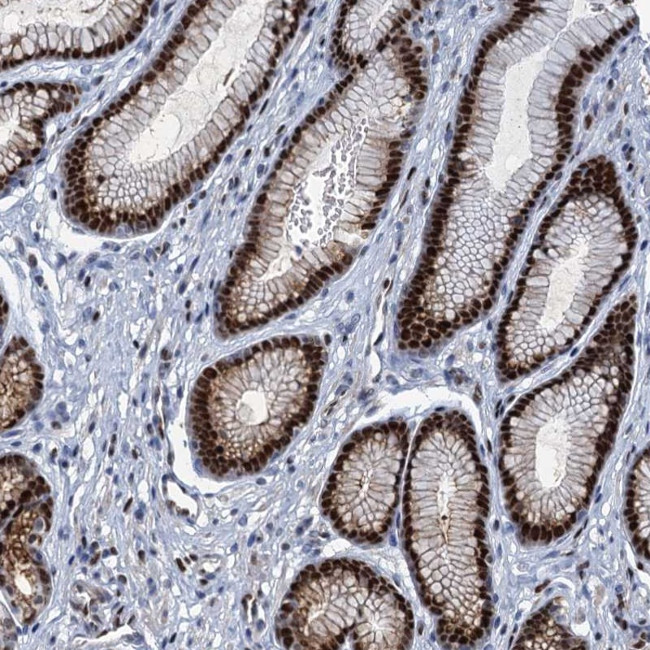 AN13D Antibody in Immunohistochemistry (Paraffin) (IHC (P))