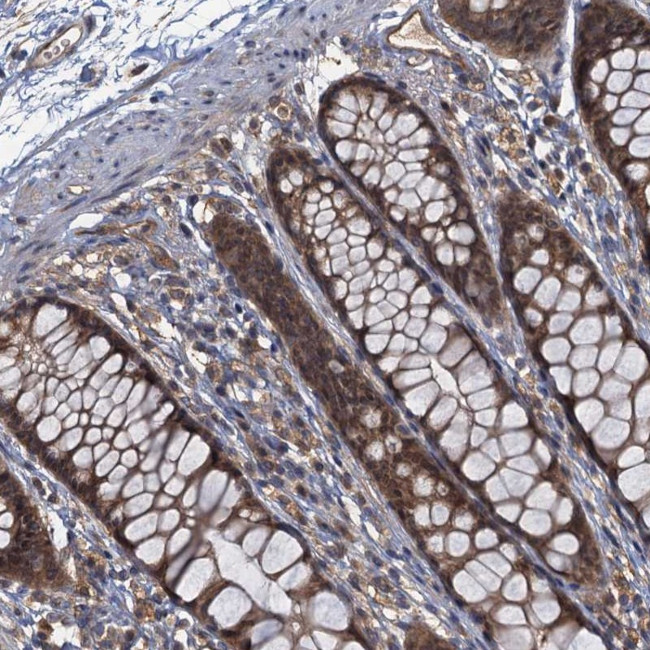 TBCK Antibody in Immunohistochemistry (Paraffin) (IHC (P))