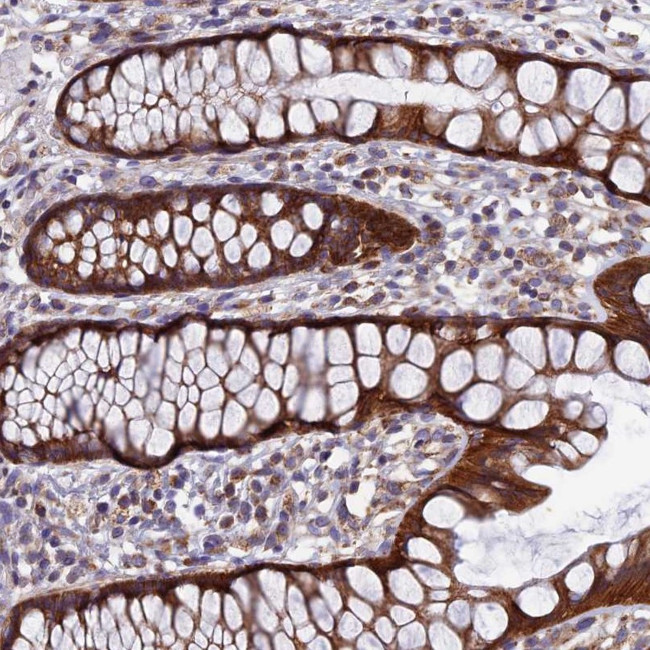 AP4S1 Antibody in Immunohistochemistry (Paraffin) (IHC (P))