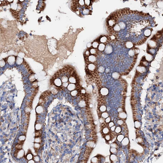 SLC10A7 Antibody in Immunohistochemistry (Paraffin) (IHC (P))