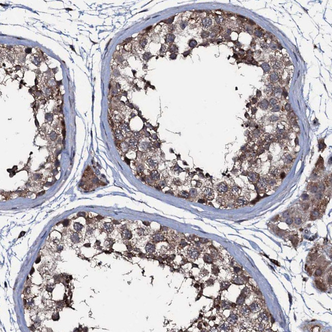 WDR66 Antibody in Immunohistochemistry (Paraffin) (IHC (P))