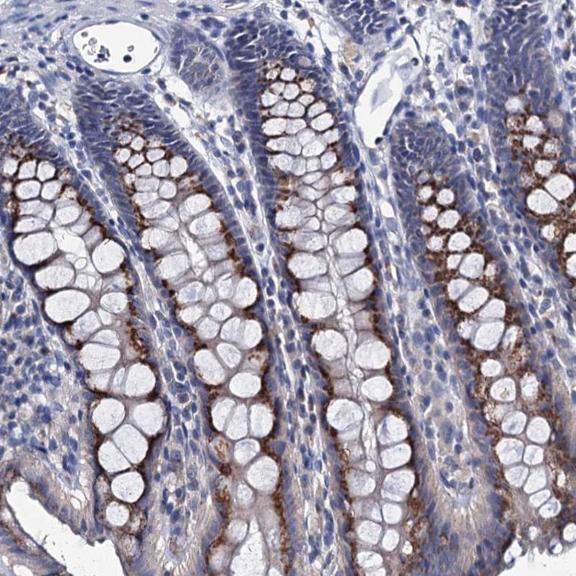 ANKRD33 Antibody in Immunohistochemistry (Paraffin) (IHC (P))