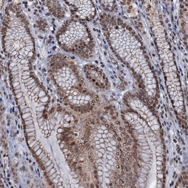 SH2D4B Antibody in Immunohistochemistry (Paraffin) (IHC (P))