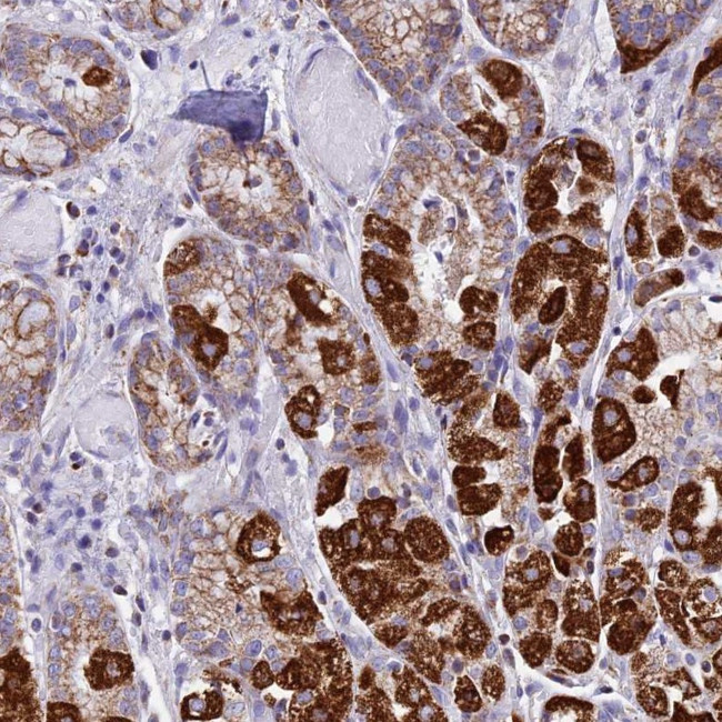 KCNG1 Antibody in Immunohistochemistry (Paraffin) (IHC (P))