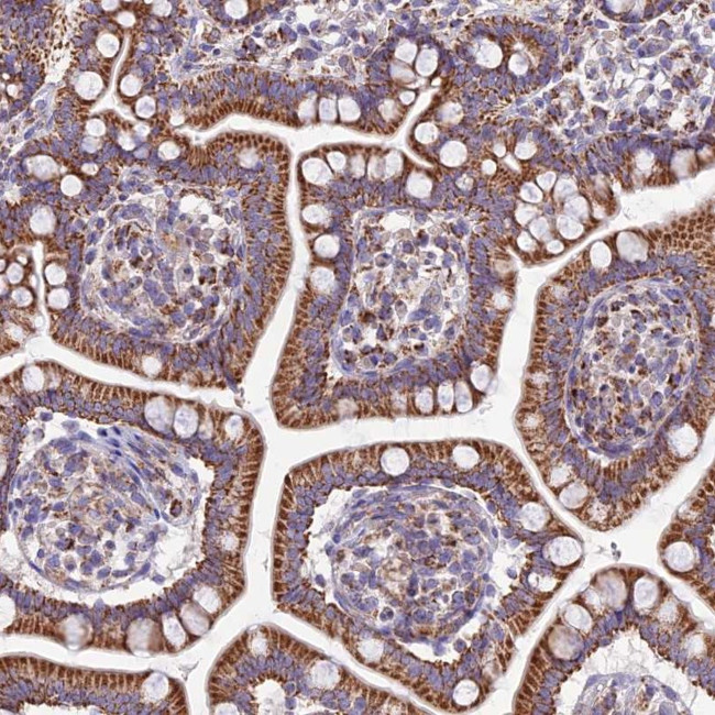 FAM186B Antibody in Immunohistochemistry (Paraffin) (IHC (P))