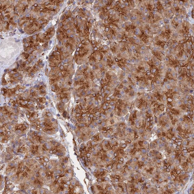 WBP11 Antibody in Immunohistochemistry (Paraffin) (IHC (P))