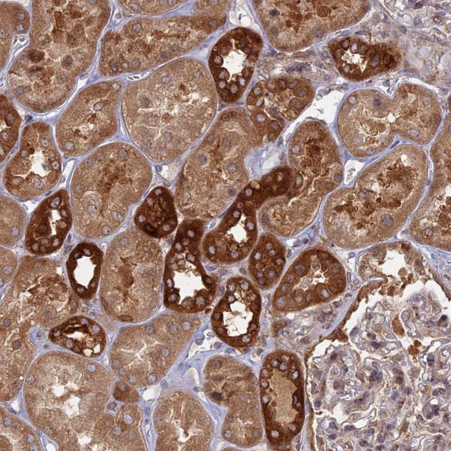 TBC1D30 Antibody in Immunohistochemistry (Paraffin) (IHC (P))