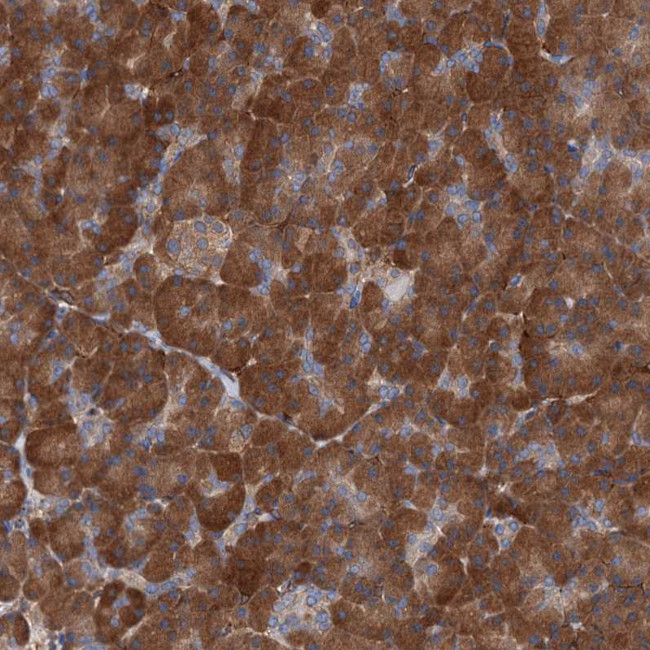 C11orf49 Antibody in Immunohistochemistry (Paraffin) (IHC (P))