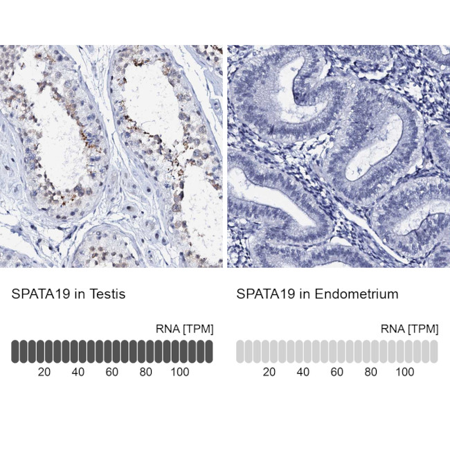 SPATA19 Antibody in Immunohistochemistry (IHC)