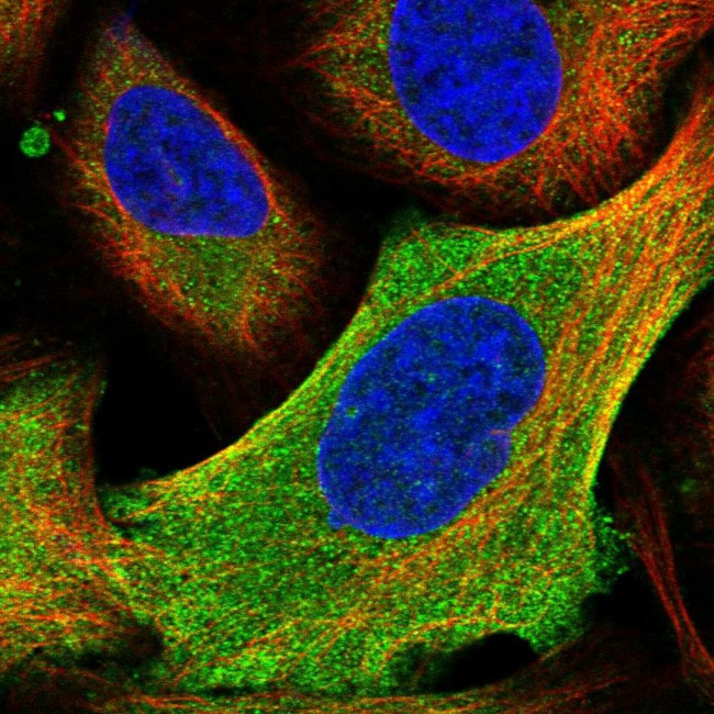 HYI Antibody in Immunocytochemistry (ICC/IF)